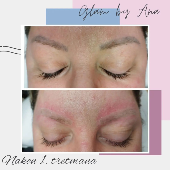 Uz Glam by Ana uklonite trajnu šminku i tetovaže bez boli!