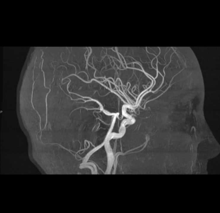 Tijekom Tjedna mozga Poliklinika Affidea Vita daje 20 posto popusta na magnetsku rezonancu!