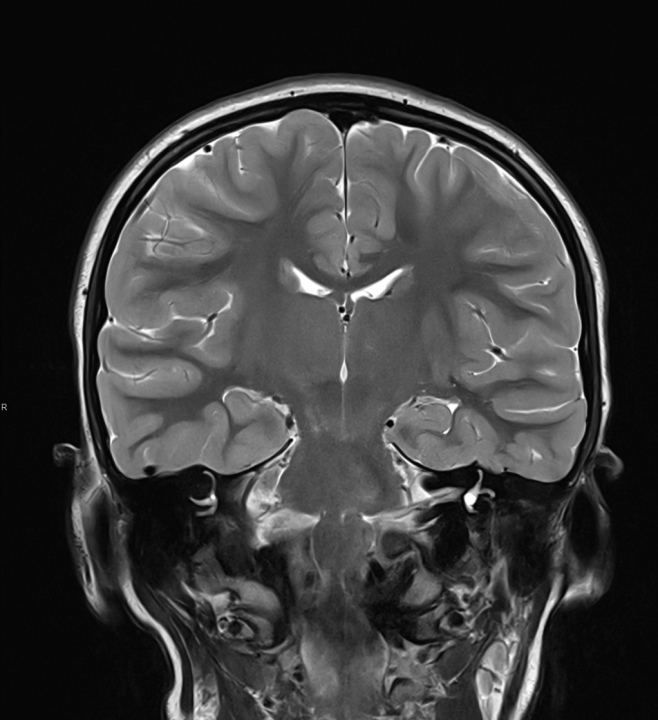 Naručite se na rendgen, ultrazvuk, CT ili MR u Poliklinici Affidea Vita