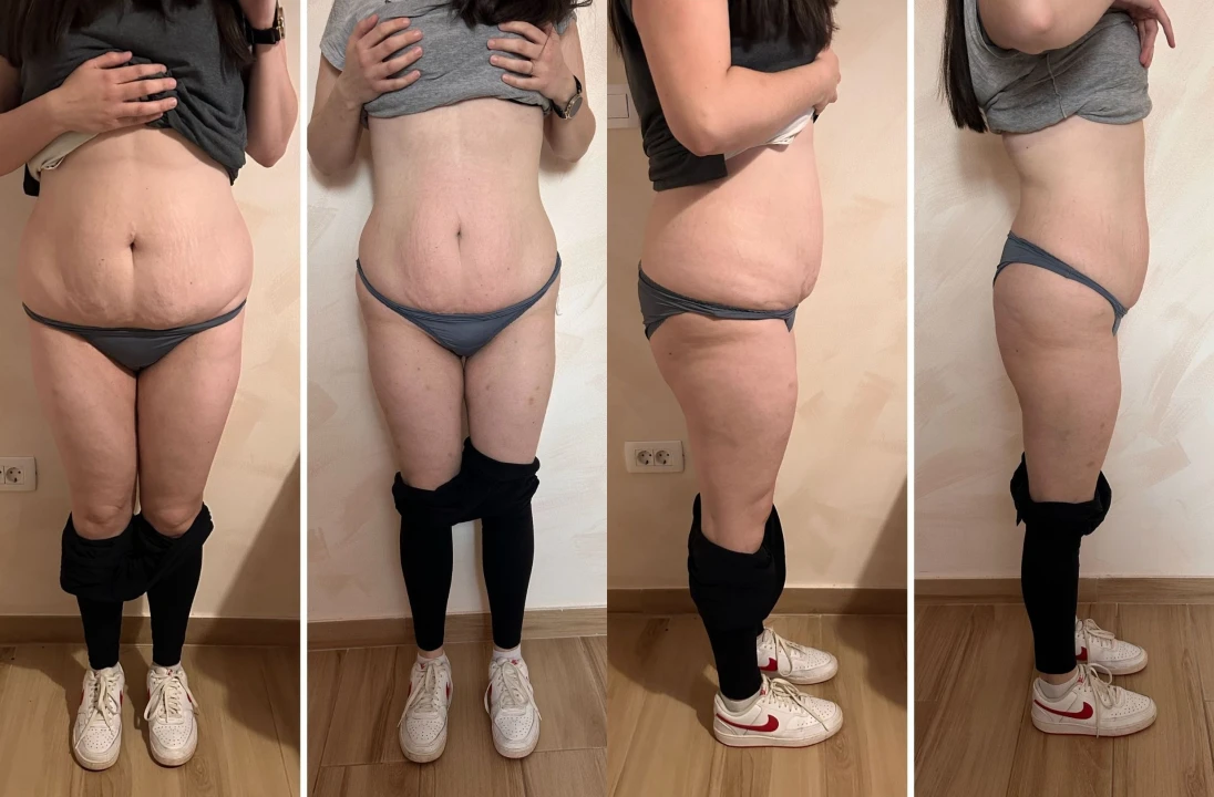 FOTO Skinite do 10 kilograma u 6 tjedana uz Beauty Clinic by Tamara