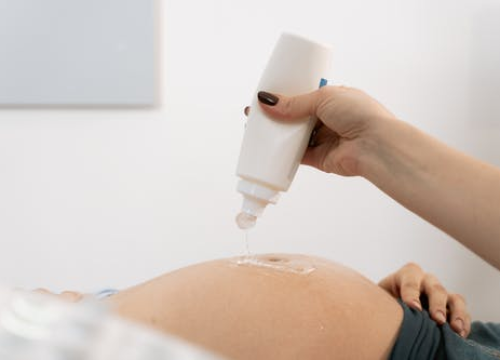 Trudnice i bebe s covidom imaju veći rizik od razvoja komplikacija nego se do sada mislilo