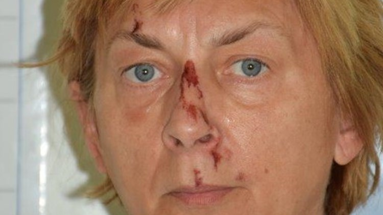 Prepoznajete li ovu ženu? Na Krku je pronađena pretučena i ne sjeća se tko je