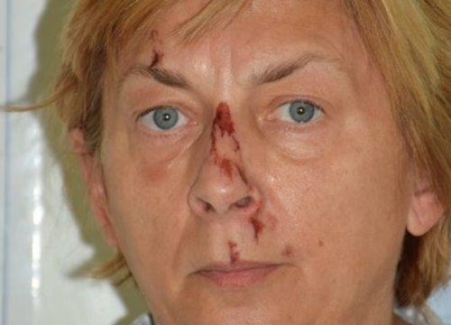 Prepoznajete li ovu ženu? Na Krku je pronađena pretučena i ne sjeća se tko je