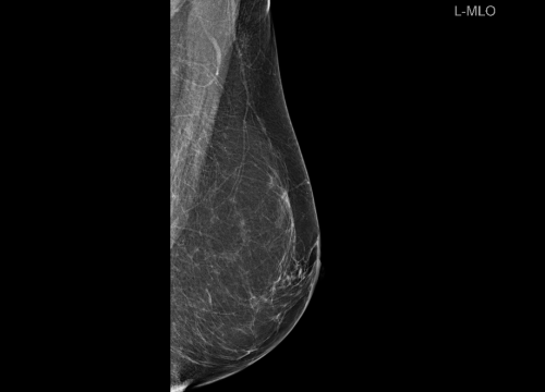 Fotografija 4 - Zakažite preventivni pregled dojke u poliklinici Affidea Vita!