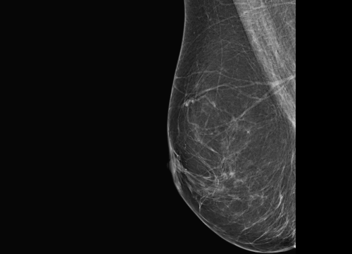 Fotografija 6 - Zakažite preventivni pregled dojke u poliklinici Affidea Vita!