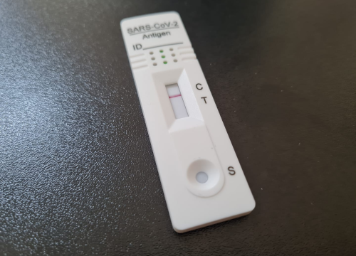 Znate li ispravno pročitati rezultat brzog testa na koronavirus? Ovo je najčešća pogreška