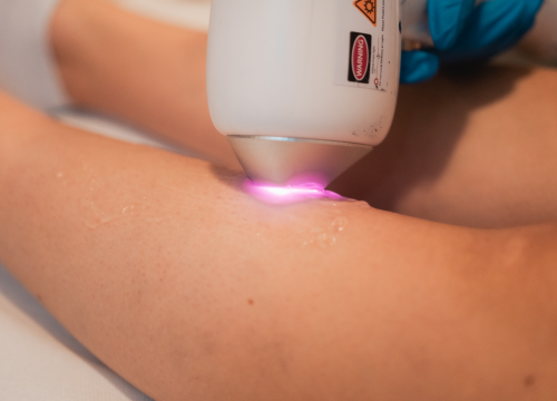 Fotografija 6 - Povodom Dana žena Beauty Bar Tamara vas časti popustom na najtraženije tretmane!