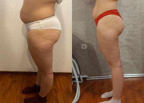 Fotografija 13 - Iskoristite vrhunske popuste od čak 40 posto u Beauty Baru Tamara!