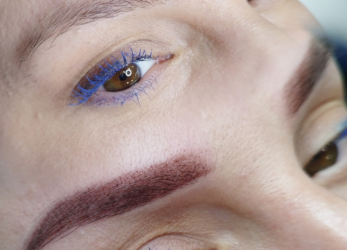 Fotografija 3 - Riješite se uraslih noktiju uz medicinsku pedikuru!