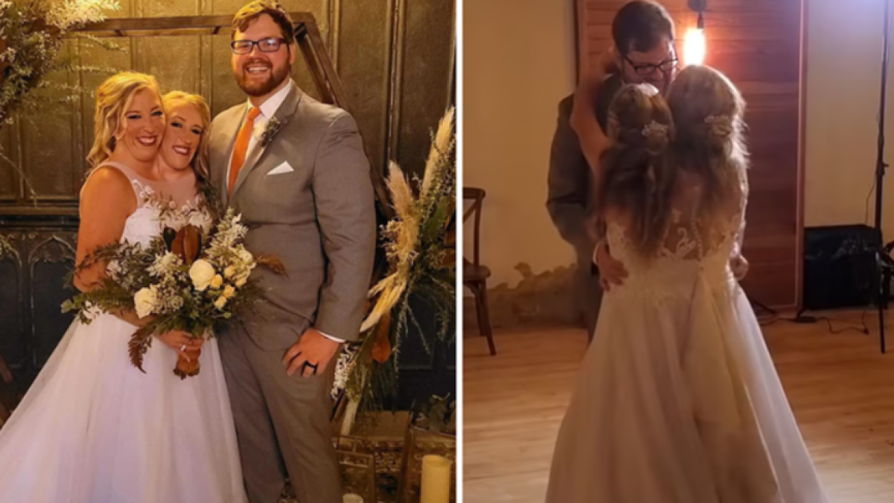 Abby i Brittany sijamske su blizanke: Voze auto, a jedna od njih se i udala