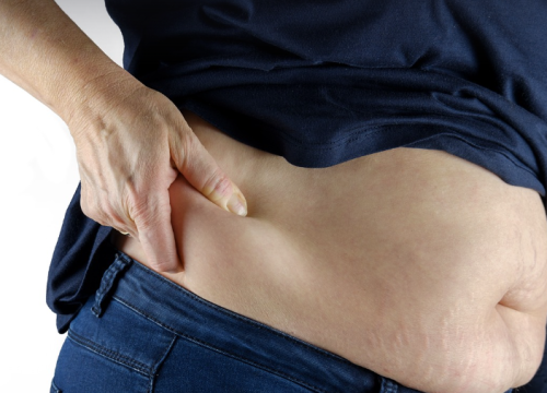 Pretilost i prehrana bogata masnoćama mogu otežati liječenje raka dojke