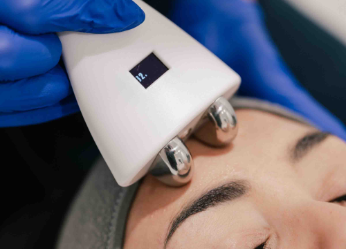 Fotografija 4 - Obnovite svoju kožu vrhunskim dermatološkim tretmanima Poliklinike Krešimir