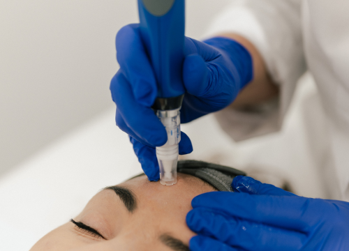 Fotografija 7 - Obnovite svoju kožu vrhunskim dermatološkim tretmanima Poliklinike Krešimir