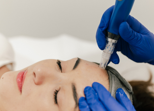 Fotografija 8 - Obnovite svoju kožu vrhunskim dermatološkim tretmanima Poliklinike Krešimir