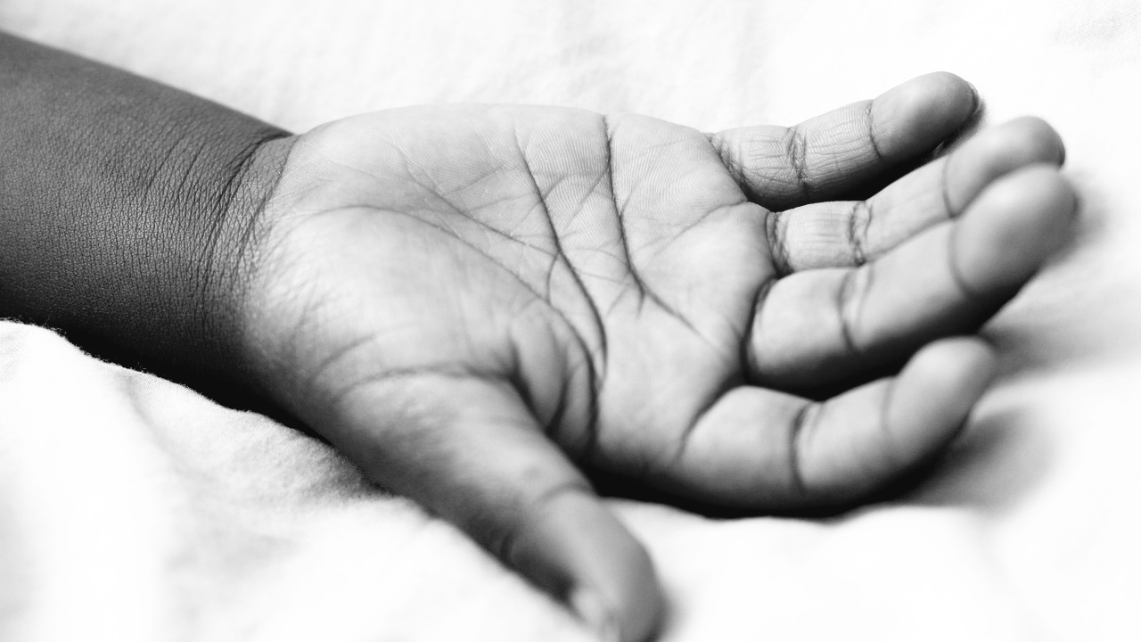 Misterij srebrnih ruku kod ovog muškarca i dalje neriješen