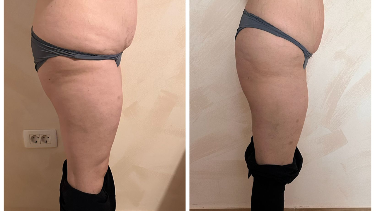 Skinite do 10 kilograma u 6 tjedana uz Beauty Clinic by Tamara