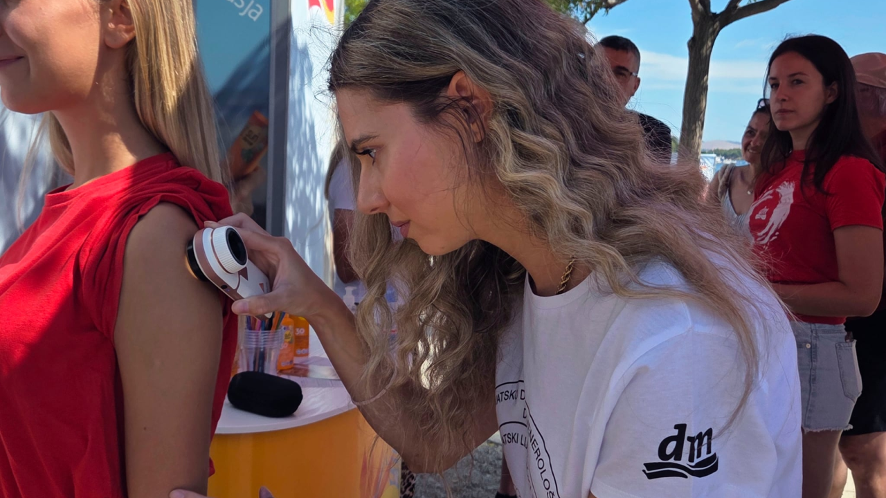 Dermatolozi u Šibeniku pregledali 110 građana, 28 upućeno na daljnje pretrage