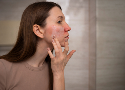 Fotografija 2 - FOTO Jesen i koža: Zašto je pravo vrijeme za promjene i novi početak