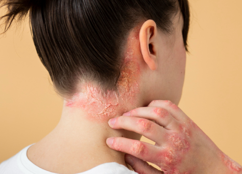 Fotografija 4 - FOTO Jesen i koža: Zašto je pravo vrijeme za promjene i novi početak