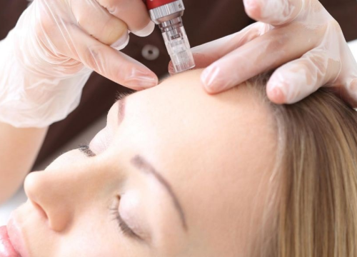 Fotografija 1 - FOTO Poliklinika Gemini pruža revolucionaran pristup zdravlju kože i to uz 20 posto popusta!