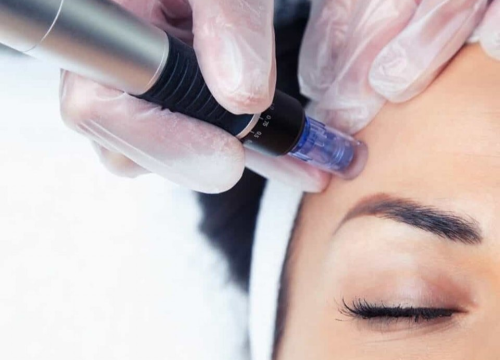 Fotografija 7 - FOTO Poliklinika Gemini pruža revolucionaran pristup zdravlju kože i to uz 20 posto popusta!